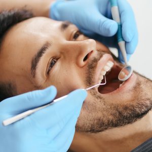 Blanqueamiento dental clínico