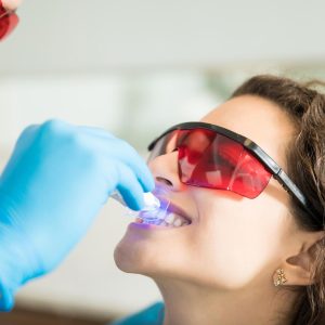 Empaste estético dental